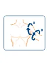 Soporte de Hombro Unilateral Thermo Med Orliman